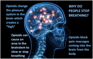 Opioids can cause respiratory depression